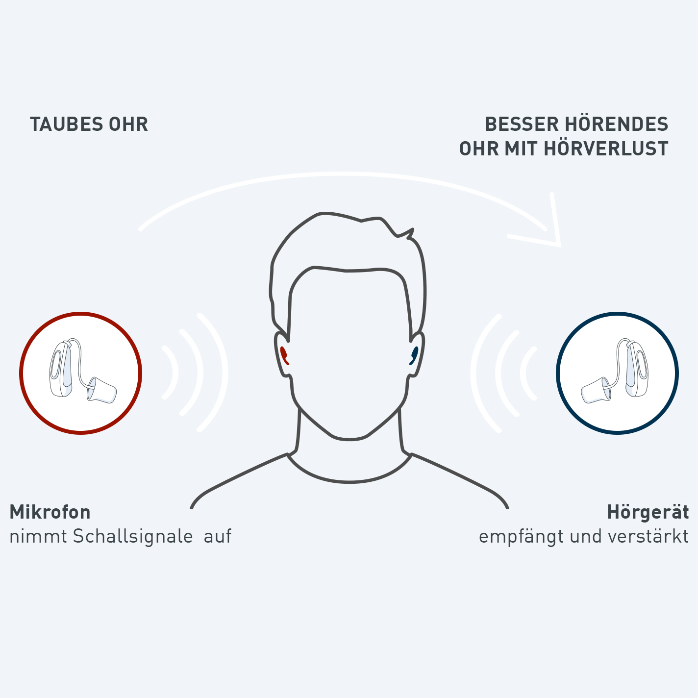 BiCROS-Hoergeraete_1x1