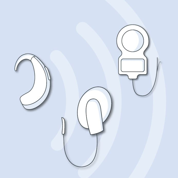 Hoerimplantat_Erstinformationen_CI-Formen_04-2025_1x1